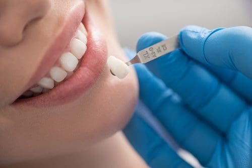 Woman in dentist chair smiling while dentist holds veneer to her face.